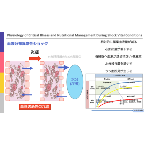 重症病態1/4 | 重症病態の生理学とショックバイタル時の栄養管理 - 画像 (2)