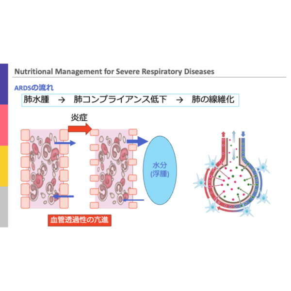 重症病態3/4 | 重症呼吸器疾患患者の栄養管理. - 画像 (2)