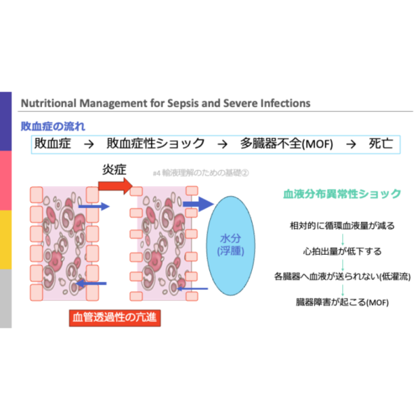 重症病態2/4 | 敗血症・重症感染症患者の栄養管理 - 画像 (3)