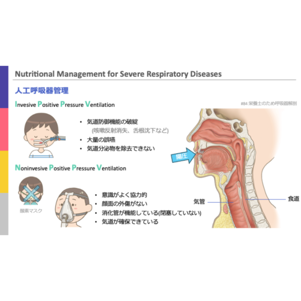 重症病態3/4 | 重症呼吸器疾患患者の栄養管理. - 画像 (5)